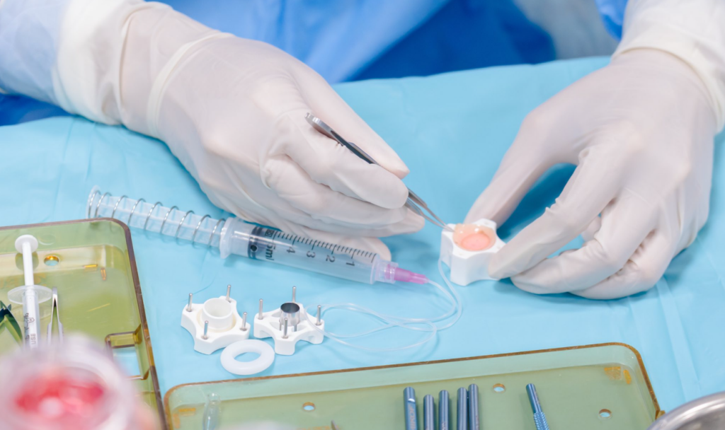 Россия и Вьетнам запускают совместную программу пересадки роговицы Россия и Вьетнам запускают совместную программу пересадки роговицы