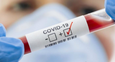 Более 10 млн человек по всему миру заразились COVID-19, число жертв превысило 500 тыс.
